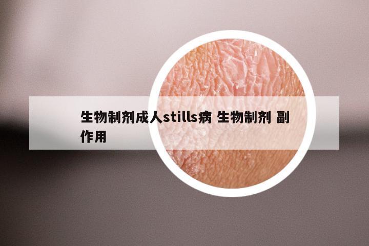 生物制剂成人stills病 生物制剂 副作用