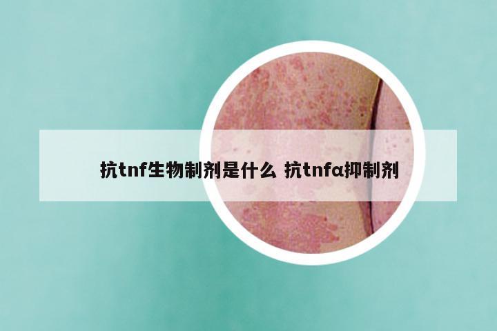抗tnf生物制剂是什么 抗tnfα抑制剂
