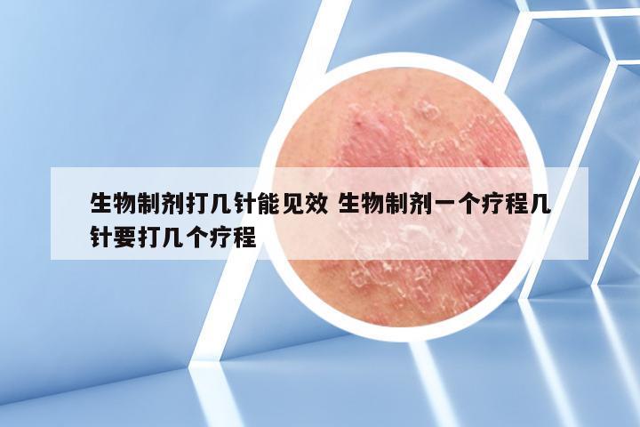 生物制剂打几针能见效 生物制剂一个疗程几针要打几个疗程