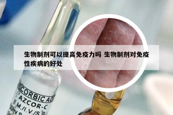 生物制剂可以提高免疫力吗 生物制剂对免疫性疾病的好处