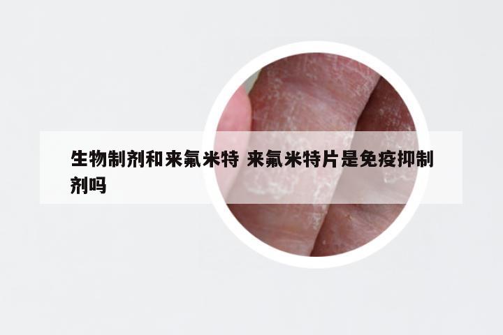 生物制剂和来氟米特 来氟米特片是免疫抑制剂吗