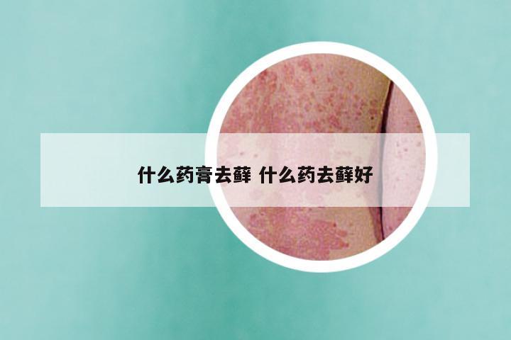 什么药膏去藓 什么药去藓好
