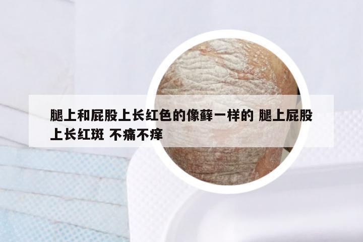 腿上和屁股上长红色的像藓一样的 腿上屁股上长红斑 不痛不痒