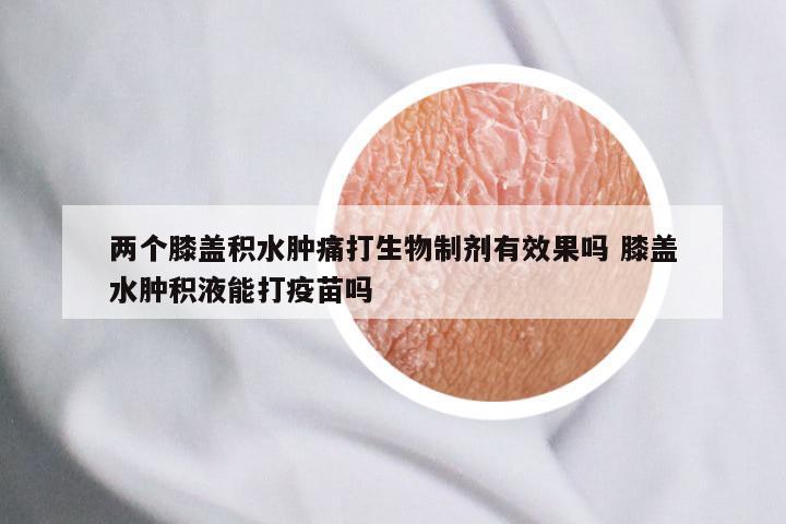 两个膝盖积水肿痛打生物制剂有效果吗 膝盖水肿积液能打疫苗吗