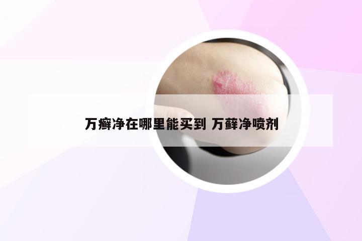 万癣净在哪里能买到 万藓净喷剂