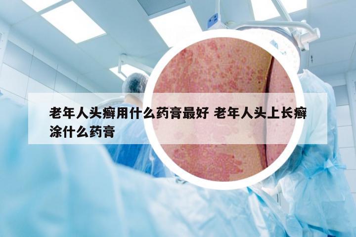 老年人头癣用什么药膏最好 老年人头上长癣涂什么药膏
