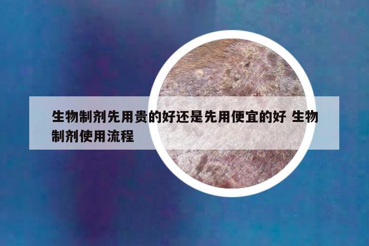 生物制剂先用贵的好还是先用便宜的好 生物制剂使用流程