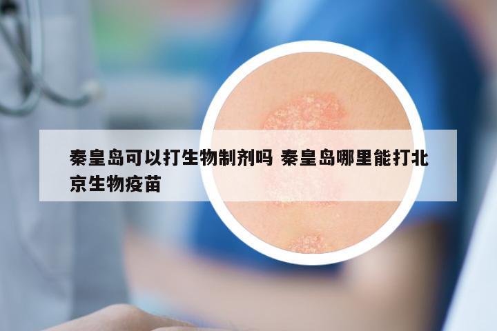 秦皇岛可以打生物制剂吗 秦皇岛哪里能打北京生物疫苗