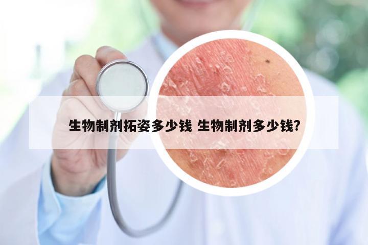 生物制剂拓姿多少钱 生物制剂多少钱?