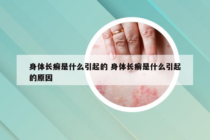 身体长癣是什么引起的 身体长癣是什么引起的原因