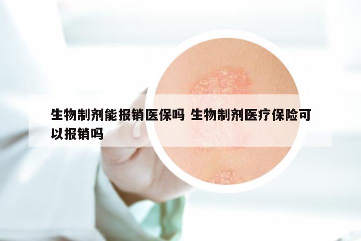 生物制剂能报销医保吗 生物制剂医疗保险可以报销吗