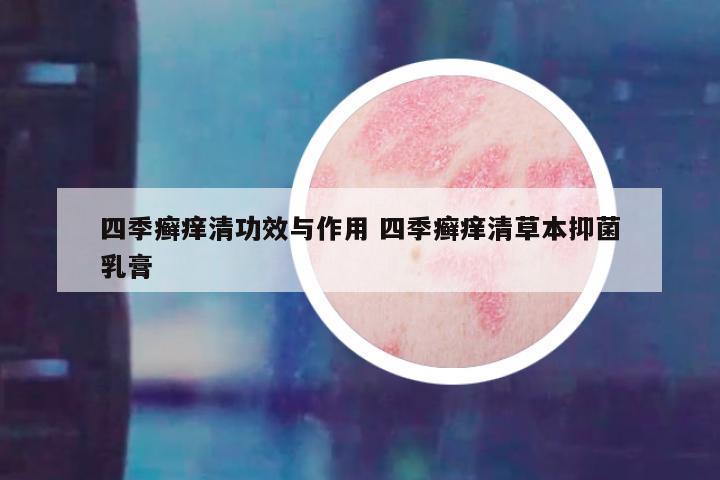 四季癣痒清功效与作用 四季癣痒清草本抑菌乳膏
