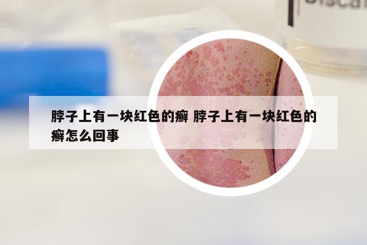 脖子上有一块红色的癣 脖子上有一块红色的癣怎么回事