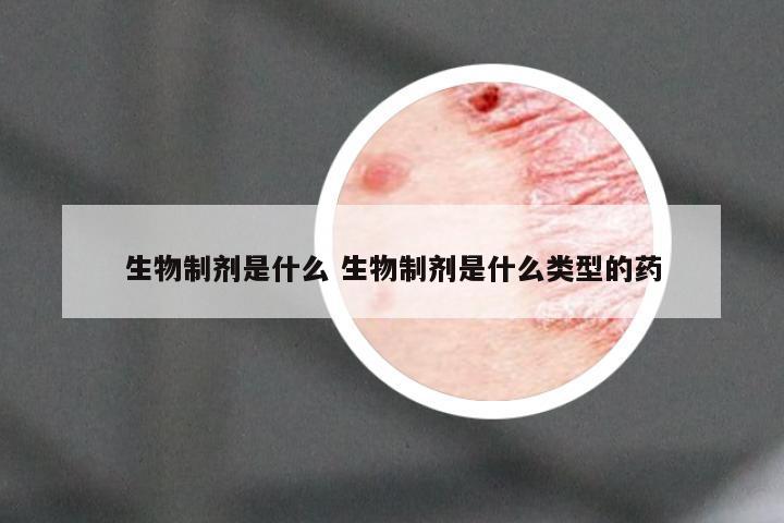生物制剂是什么 生物制剂是什么类型的药