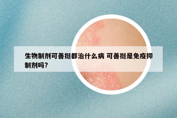 生物制剂可善挺都治什么病 可善挺是免疫抑制剂吗?