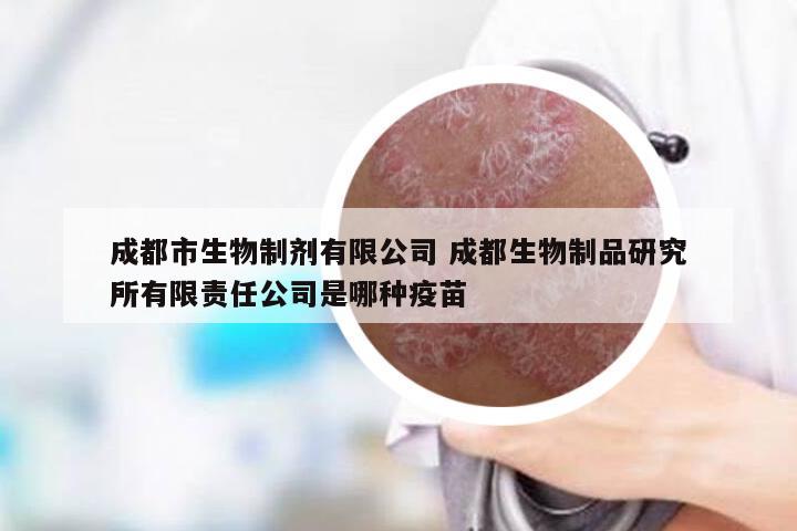成都市生物制剂有限公司 成都生物制品研究所有限责任公司是哪种疫苗