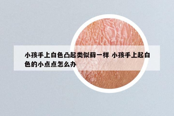 小孩手上白色凸起类似藓一样 小孩手上起白色的小点点怎么办