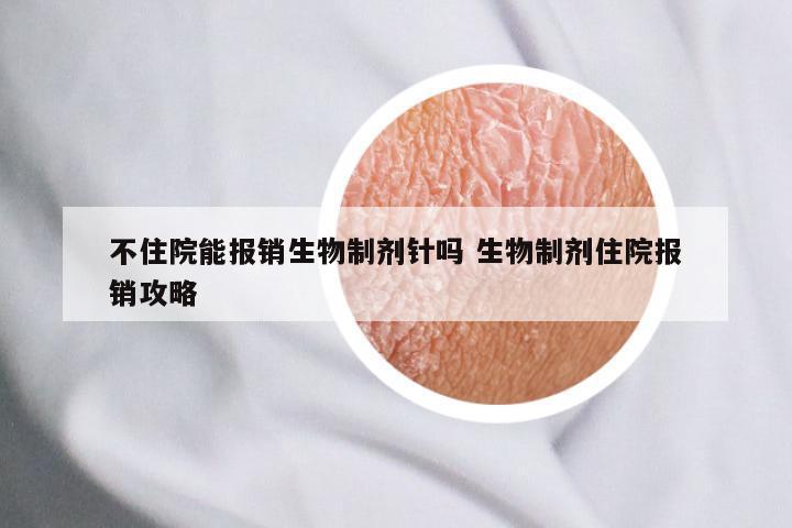 不住院能报销生物制剂针吗 生物制剂住院报销攻略