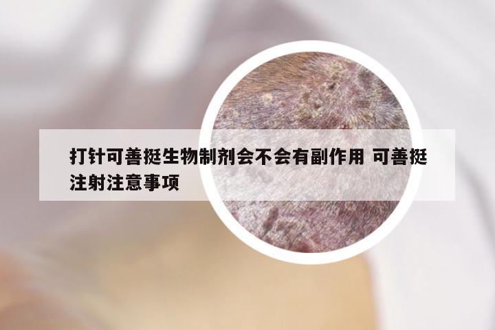 打针可善挺生物制剂会不会有副作用 可善挺注射注意事项