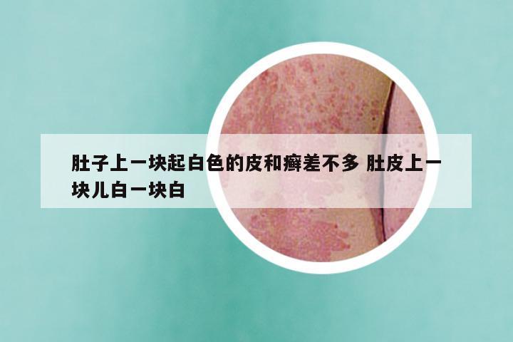肚子上一块起白色的皮和癣差不多 肚皮上一块儿白一块白