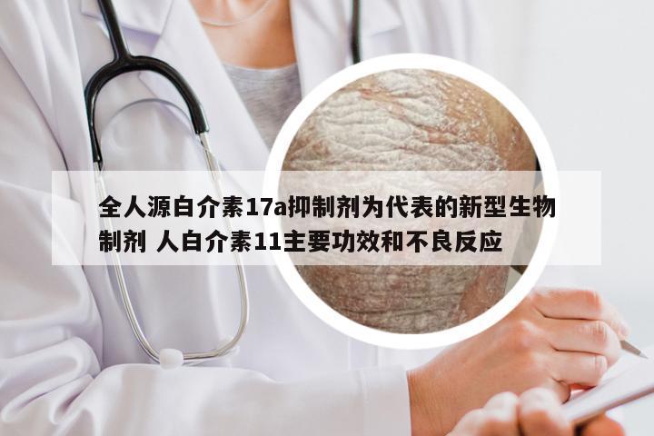 全人源白介素17a抑制剂为代表的新型生物制剂 人白介素11主要功效和不良反应