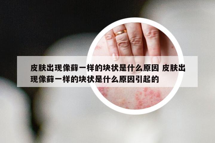 皮肤出现像藓一样的块状是什么原因 皮肤出现像藓一样的块状是什么原因引起的