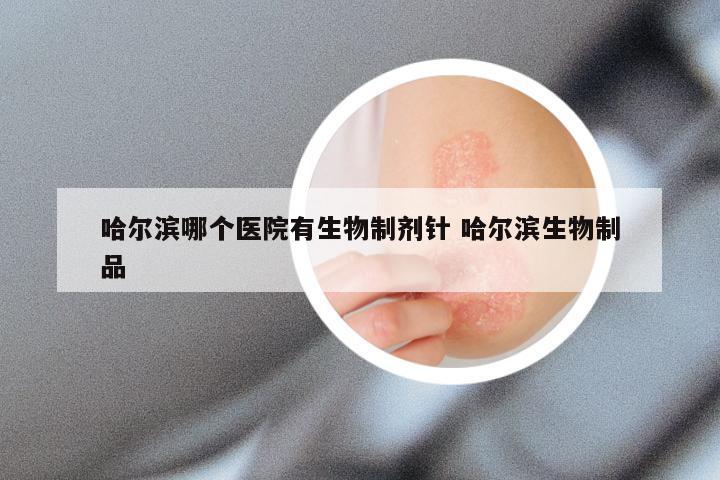 哈尔滨哪个医院有生物制剂针 哈尔滨生物制品
