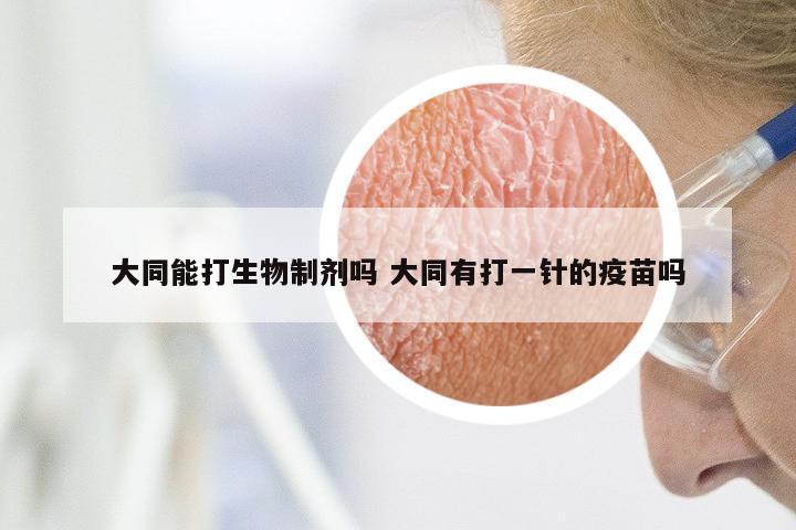 大同能打生物制剂吗 大同有打一针的疫苗吗
