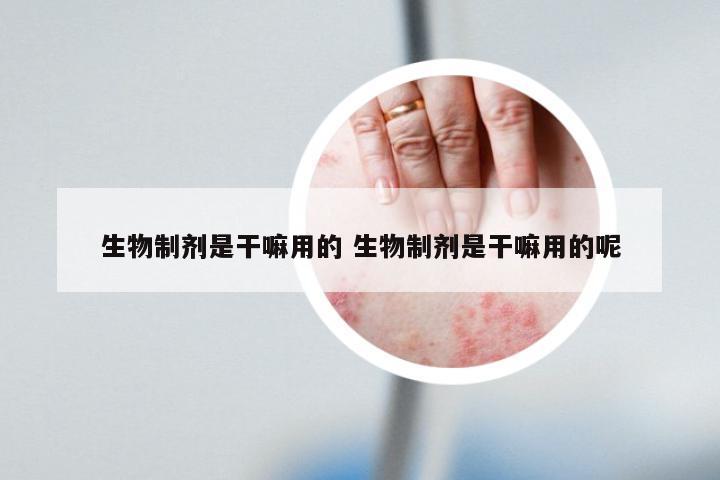 生物制剂是干嘛用的 生物制剂是干嘛用的呢