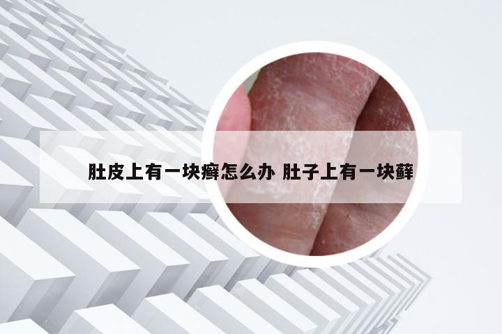 肚皮上有一块癣怎么办 肚子上有一块藓