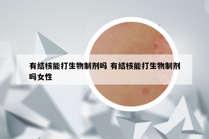 有结核能打生物制剂吗 有结核能打生物制剂吗女性