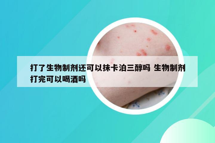 打了生物制剂还可以抹卡泊三醇吗 生物制剂打完可以喝酒吗