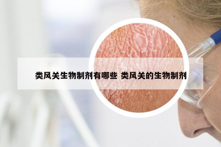 类风关生物制剂有哪些 类风关的生物制剂