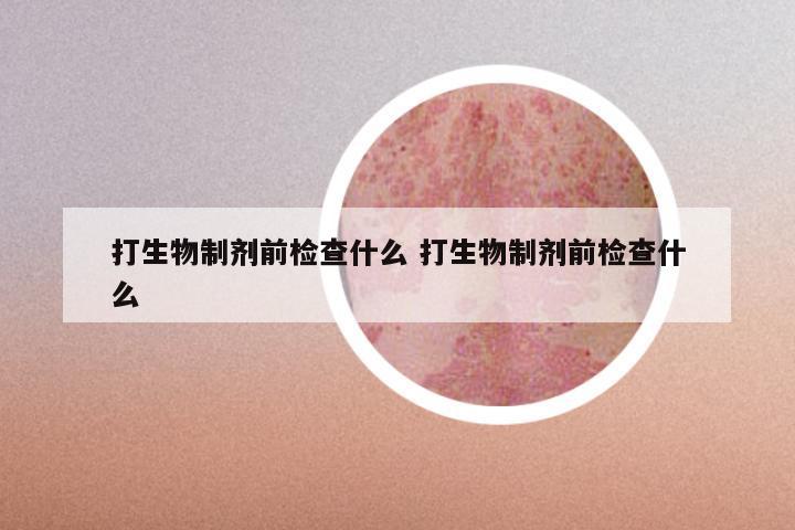 打生物制剂前检查什么 打生物制剂前检查什么