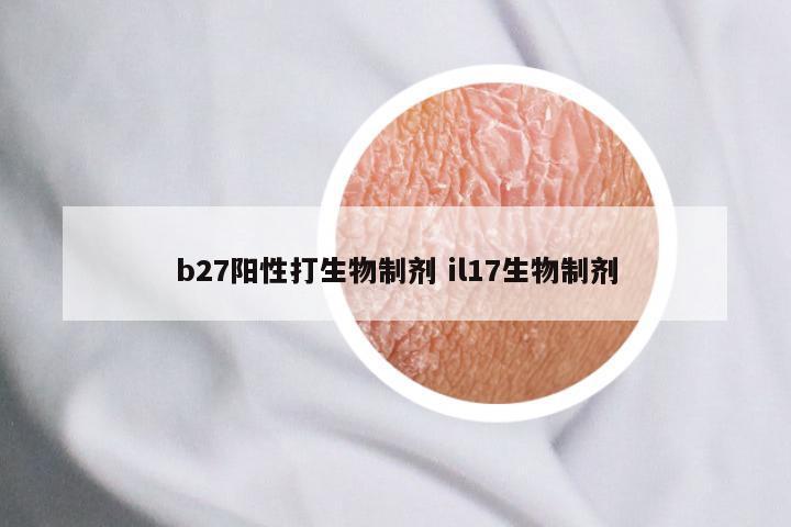 b27阳性打生物制剂 il17生物制剂