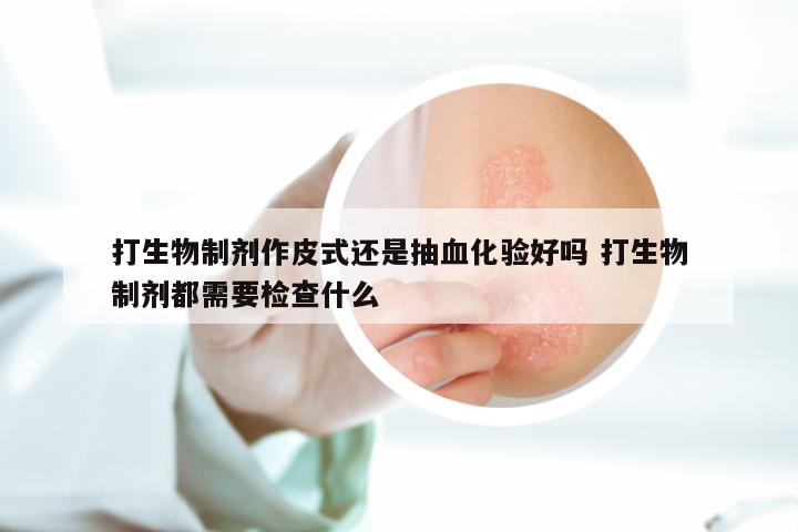 打生物制剂作皮式还是抽血化验好吗 打生物制剂都需要检查什么
