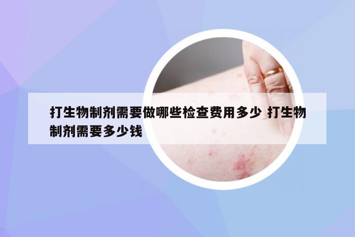 打生物制剂需要做哪些检查费用多少 打生物制剂需要多少钱
