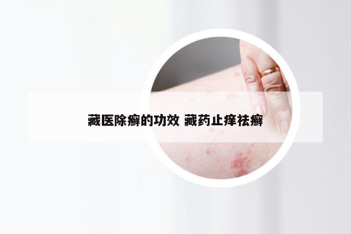 藏医除癣的功效 藏药止痒祛癣