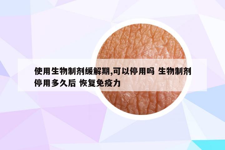 使用生物制剂缓解期,可以停用吗 生物制剂停用多久后 恢复免疫力