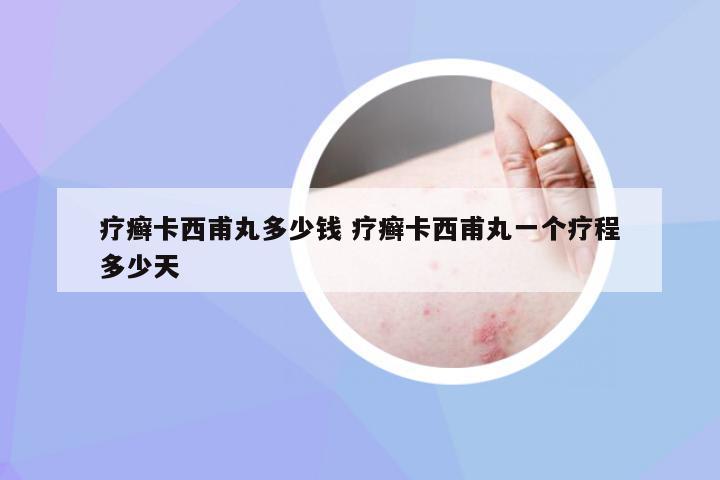 疗癣卡西甫丸多少钱 疗癣卡西甫丸一个疗程多少天