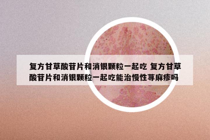 复方甘草酸苷片和消银颗粒一起吃 复方甘草酸苷片和消银颗粒一起吃能治慢性荨麻疹吗