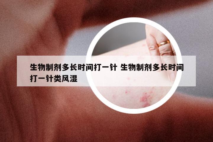 生物制剂多长时间打一针 生物制剂多长时间打一针类风湿