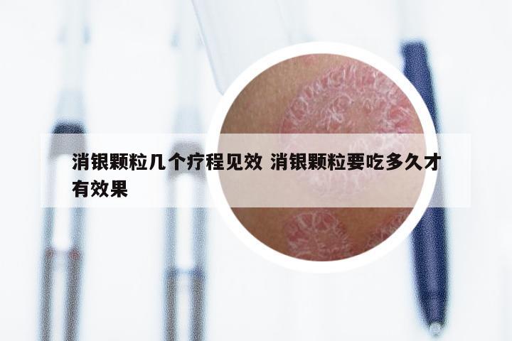 消银颗粒几个疗程见效 消银颗粒要吃多久才有效果