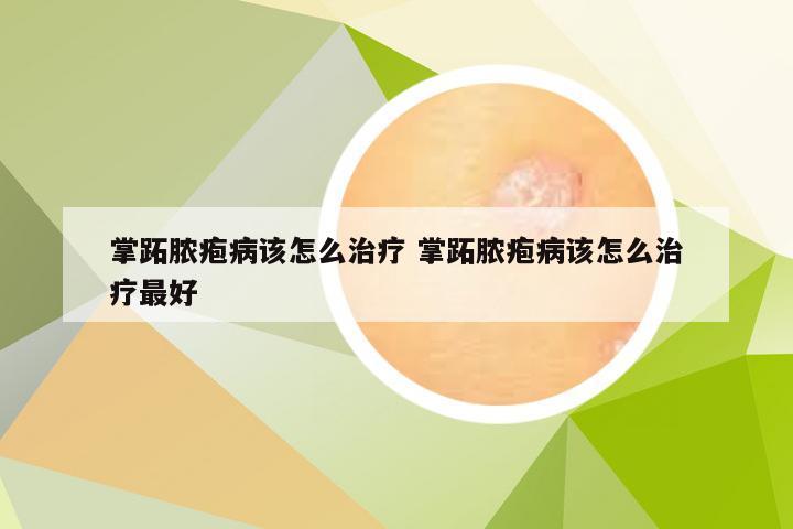 掌跖脓疱病该怎么治疗 掌跖脓疱病该怎么治疗最好