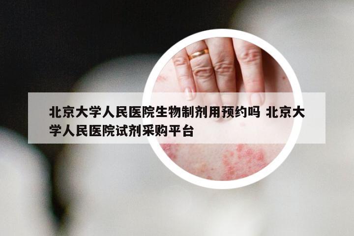 北京大学人民医院生物制剂用预约吗 北京大学人民医院试剂采购平台