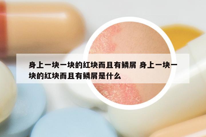 身上一块一块的红块而且有鳞屑 身上一块一块的红块而且有鳞屑是什么