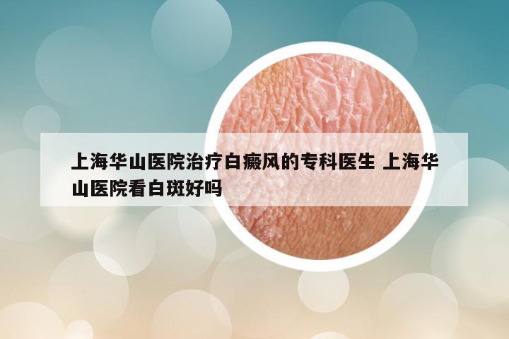 上海华山医院治疗白癜风的专科医生 上海华山医院看白斑好吗