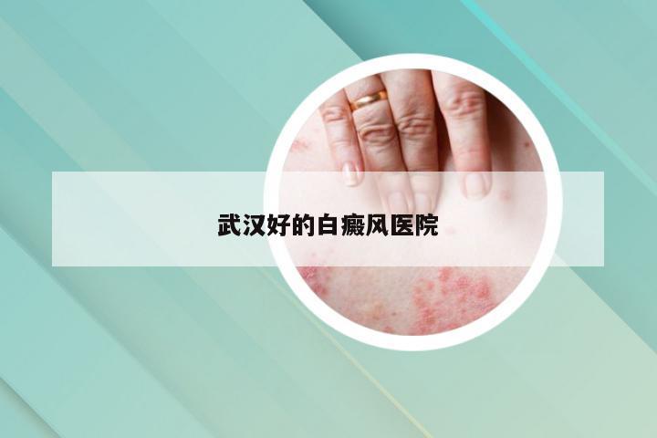 武汉好的白癜风医院