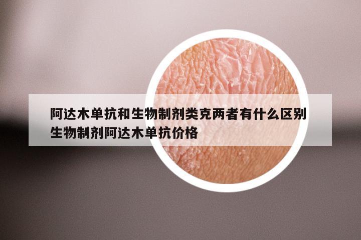 阿达木单抗和生物制剂类克两者有什么区别 生物制剂阿达木单抗价格
