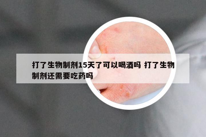 打了生物制剂15天了可以喝酒吗 打了生物制剂还需要吃药吗